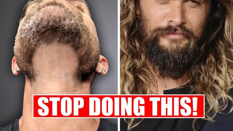 7 Beard Mistakes That Are Ruining Your Look 5 7 worst beard mistakes men make